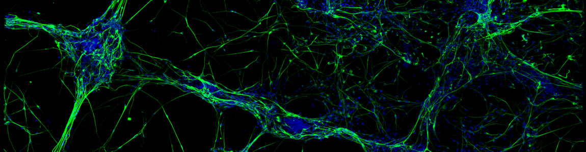 neuroni
