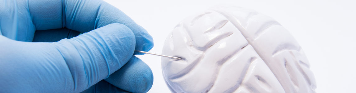 tumori gliomi pediatrici biomarker