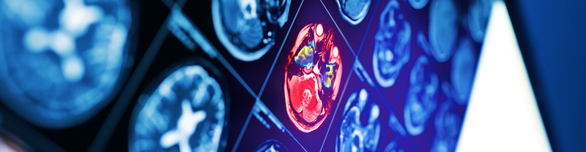 neuroimmagine