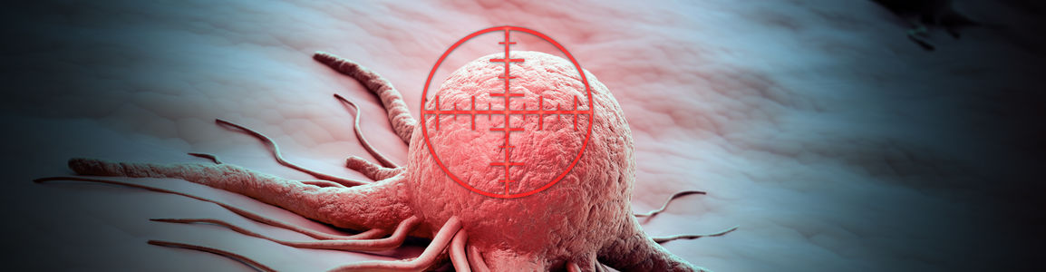 tumore pancreas tumore pancreas
