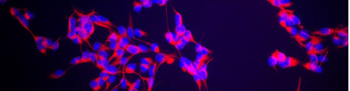 cellule staminali neurali