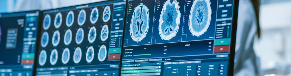 Master New Trends nel trattamento della patologia cerebrovascolare 