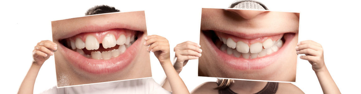 Master Odontostomatologia in età evolutiva 