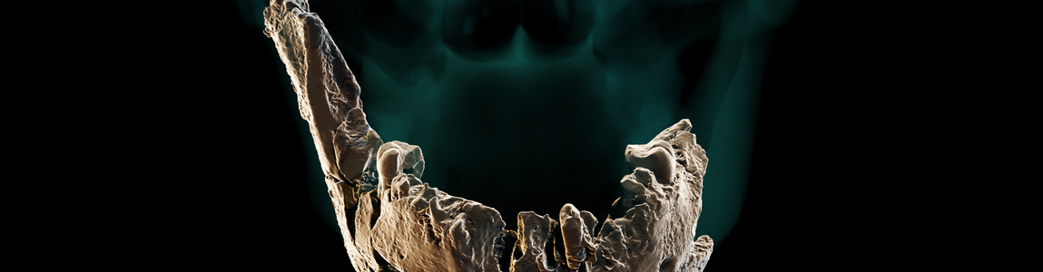 Neanderthal Neanderthal