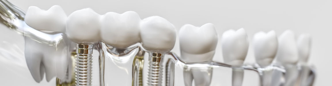 denti