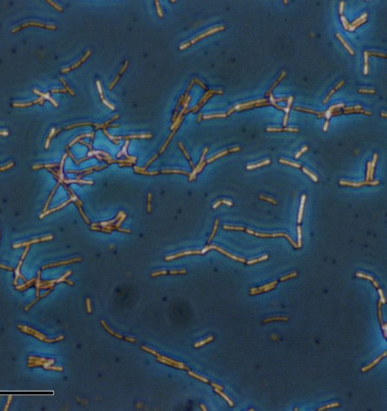 Pediatrics: "PANS/PANDAS" Syndrome Associated with an Alteration of Gut Microbiota