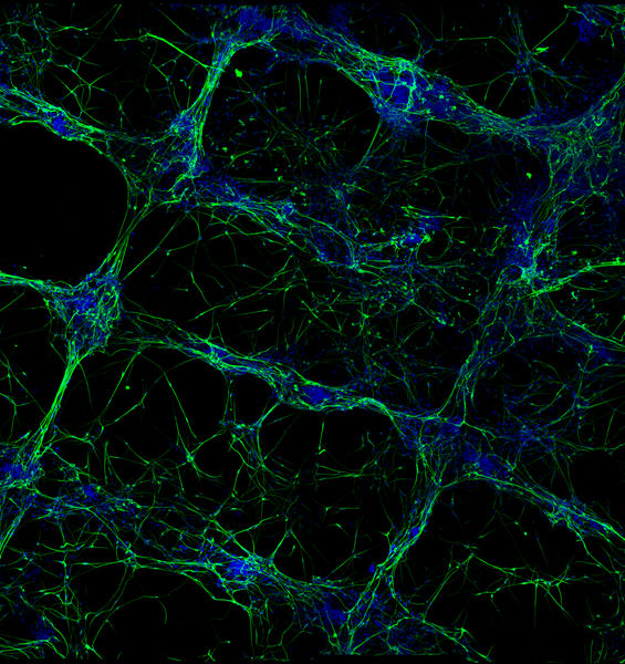 We Can Now Bio-Print Neurons