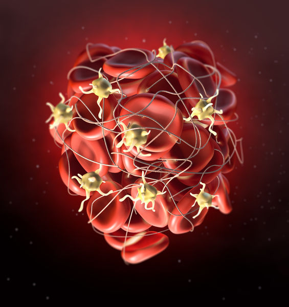 Infarto del miocardio: un batterio intestinale ne favorisce l’insorgenza 