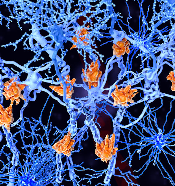Sclerosi multipla: un modello sperimentale dimostra il ruolo della risposta immunitaria 