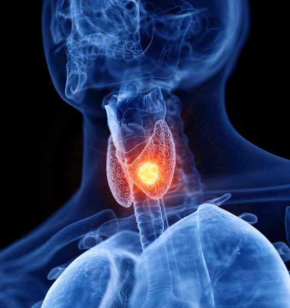  A 10 anni dalla sua istituzione, l’Osservatorio Italiano dei Carcinomi Tiroidei (ITCO) ha presentato al Senato il Report 2025