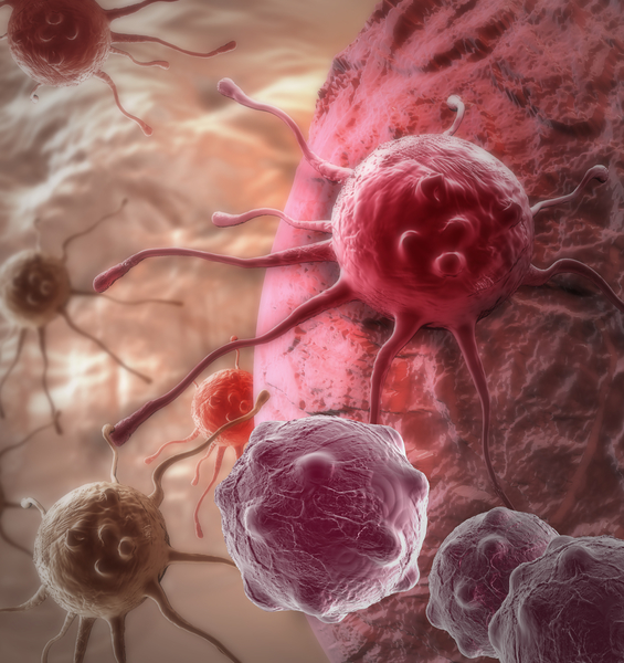 Organoids (in vitro brains) to study pediatric brain tumors