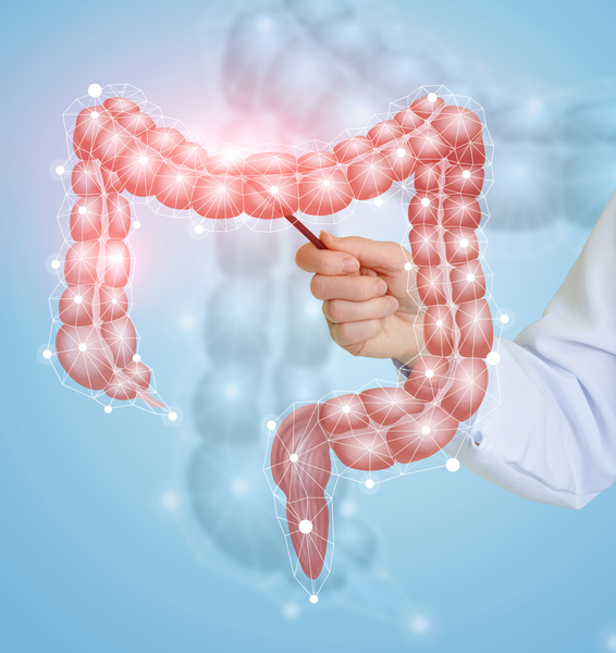 Colorectal Cancer: Identification of a New Therapeutic Target
