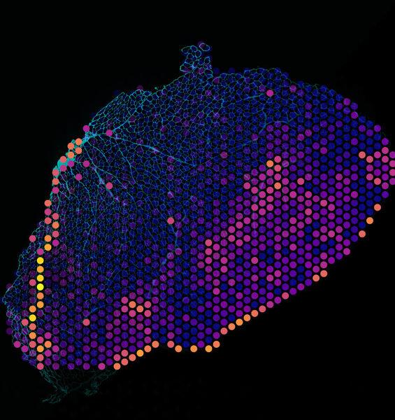 Spatial Transcriptomic: una metodica innovativa che svela informazioni fondamentali sull’apparato muscolo scheletrico