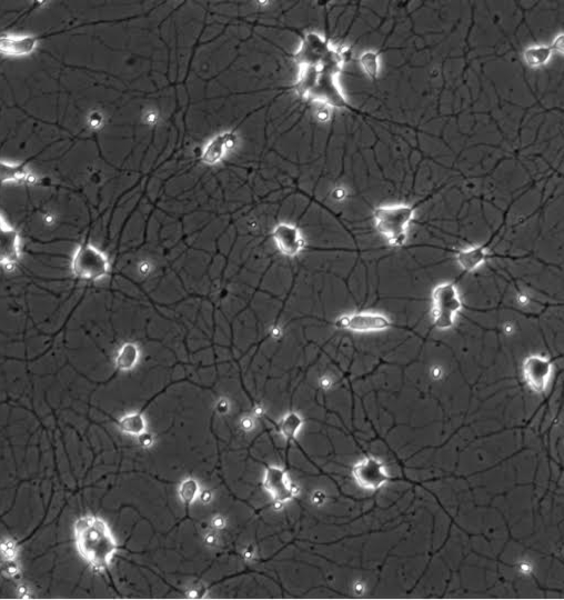 StressFUS project results on ALS published