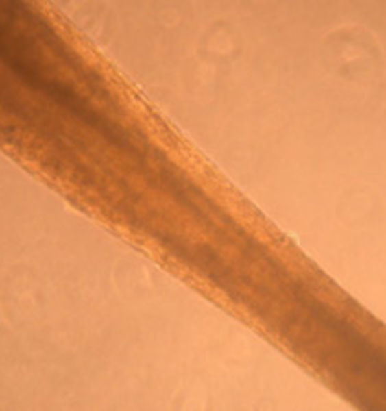 Un cerotto biologico per il cuore danneggiato