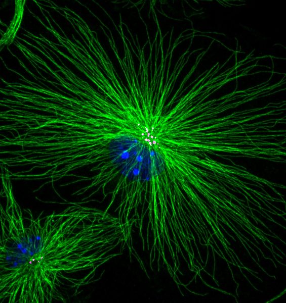 Scoperto un nuovo meccanismo di attivazione del sistema immunitario cerebrale