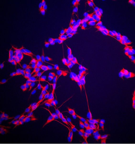 Genes Implicated in Brain Aging Identified