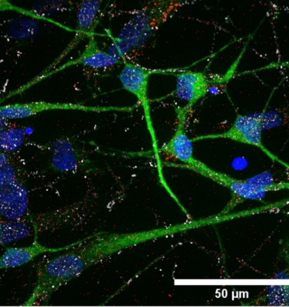 I primi organoidi cerebrali in 3D per lo studio della Sindrome dell’X fragile