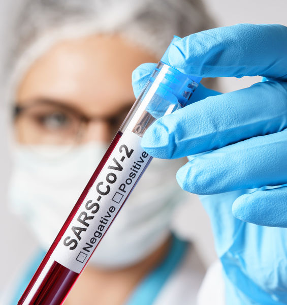 Pandemia da SARS-CoV-2: aspetti virali, epidemiologici, clinici, immunologici e terapeutici. Rivedi il webinar in un video