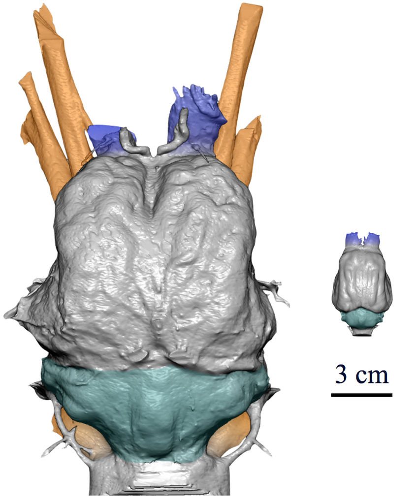 Confronto modelli 3D degli encefali 