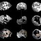Le tre precedenti ricostruzioni in gesso del cranio di Ceprano