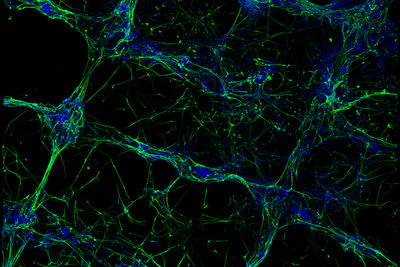 neuroni
